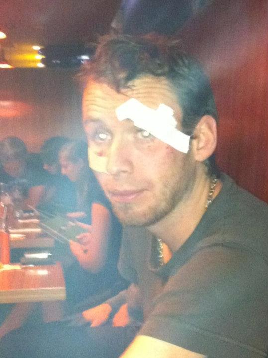 Micky in a restaurant after visiting the hospital.